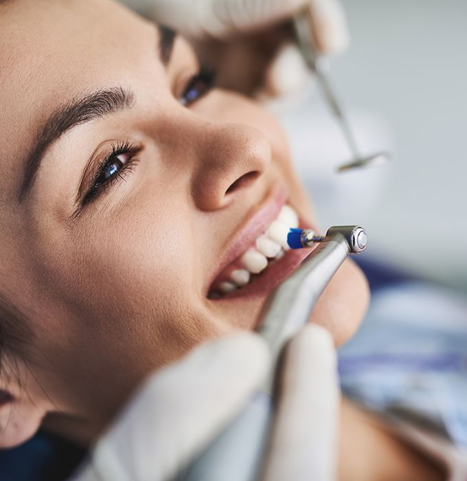 Facial closeup of woman with brown hair smiling as dentist polishes her teeth